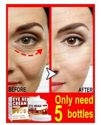Soothing Eye Cream for Dark Circles & Puffiness